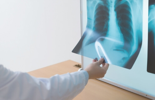 X線検査(レントゲン検査)の目的と検査方法